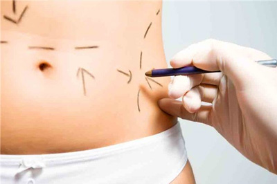 Diferença entre abdominoplastia e lipoescultura - Dr. Edgar Lopez
